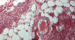 Seção de pulmão humano