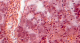 Seção da glândula pituitária