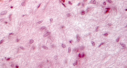 Seção da glândula pituitária