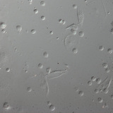 Red blood cells of a Drosophila larva Red blood cells of a Drosophila larva