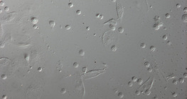 Glóbulos vermelhos de uma larva de Drosophila