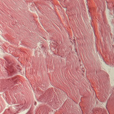 Tendão (corte transversal)