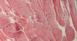 Tendão (secção transversal)