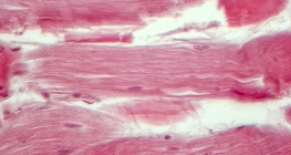 Tendão (secção longitudinal)