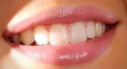 ¿QUÉ SABEMOS DE LOS DIENTES?