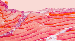 ¿Qué tejidos componen nuestros músculos?