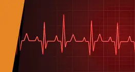 El ritmo del corazón