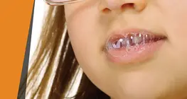 Saliva "abrasante"