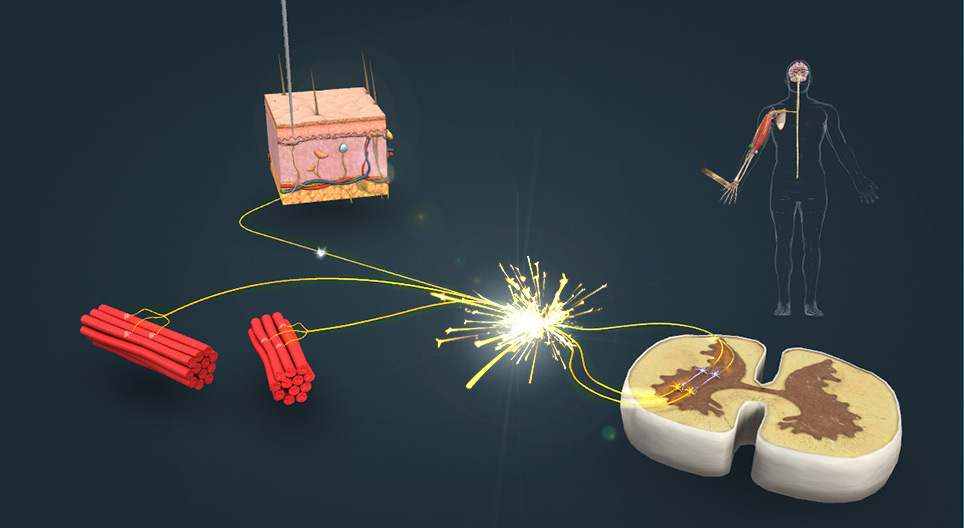 Reflexo flexor (Nociceptivo)